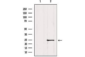Western blot analysis of extracts from Mouse brain, using MIXL1 Antibody.