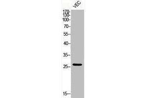 Western Blot analysis of VEC cells using Phospho-Bcl-2 (S70) Polyclonal Antibody (Bcl-2 antibody  (pSer70))