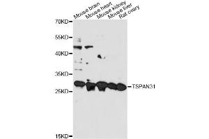 Western blot analysis of extracts of various cell lines, using TSPAN31 antibody. (TSPAN31 antibody)