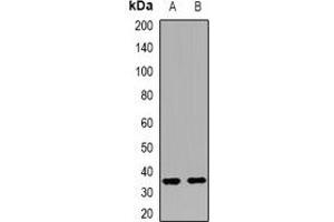 Western blot analysis of LPAAT alpha expression in mouse kidney (A), mouse brain (B) whole cell lysates.