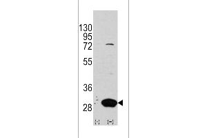 Western blot analysis of Latexin using rabbit polyclonal Latexin Antibody using 293 cell lysates (2 ug/lane) either nontransfected (Lane 1) or transiently transfected with the LXN gene (Lane 2). (Latexin antibody  (AA 78-107))