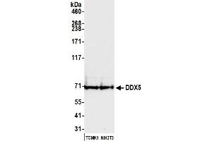 Western Blotting (WB) image for anti-DEAD (Asp-Glu-Ala-Asp) Box Polypeptide 5 (DDX5) (C-Term) antibody (ABIN7454642)