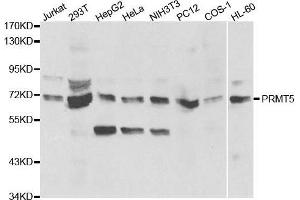 Western blot analysis of extracts of various cell lines, using PRMT5 antibody. (PRMT5 antibody  (AA 40-140))