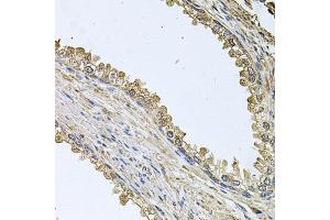Immunohistochemistry of paraffin-embedded human prostate using MEMO1 antibody  at dilution of 1:100 (40x lens). (MEMO1 antibody  (AA 1-297))