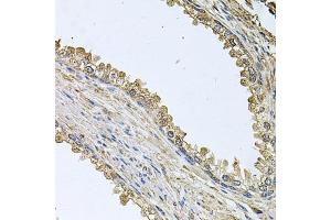 Immunohistochemistry of paraffin-embedded human prostate using MEMO1 antibody  at dilution of 1:100 (40x lens). (MEMO1 antibody  (AA 1-297))