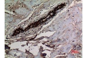 Immunohistochemistry (IHC) analysis of paraffin-embedded Human Breast, antibody was diluted at 1:100. (KRT8 antibody  (acLys483))