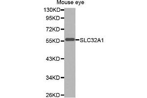 Western Blotting (WB) image for anti-Solute Carrier Family 32 (GABA Vesicular Transporter), Member 1 (SLC32A1) antibody (ABIN3023496) (SLC32A1 antibody)