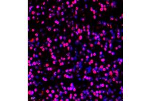 Immunofluorescence of paraffin embedded rat embryonic rat using BRN3A (ABIN7075163) at dilution of 1:650 (400x lens) (POU4F1 antibody)