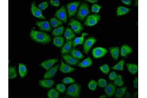 Immunofluorescence staining of Hela cells with ABIN7146664 at 1:66, counter-stained with DAPI. (Caprin-1 antibody  (AA 573-703))
