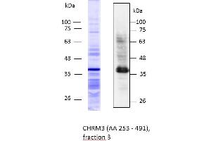 Image no. 1 for Cholinergic Receptor, Muscarinic 3 (CHRM3) (AA 253-491) protein (Strep Tag,His tag) (ABIN3088334) (CHRM3 Protein (AA 253-491) (Strep Tag,His tag))