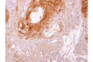 IHC-P Image Prostasin antibody [N1C2] detects Prostasin protein at cytosol on Ca922 xenograft by immunohistochemical analysis. (PRSS8 antibody  (Center))