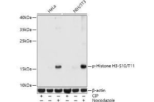 Western blot analysis of extracts of various cell lines, using Phospho-Histone H3-S10/T11 antibody (ABIN7267688) at 1:1000 dilution. (Histone 3 antibody  (H3S10p, H3T11p))