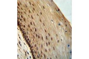 Formalin fixed, paraffin embedded human cervical tissue stained with SPDYE3 Antibody  followed by peroxidase conjugation of the secondary antibody and DAB staining. (SPDYE3 antibody  (Middle Region))