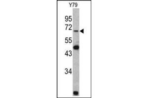 Western blot: Lamin B2 Antibody staining of Y79 cell line lysates (35 µg/lane). (Lamin B2 antibody  (C-Term))
