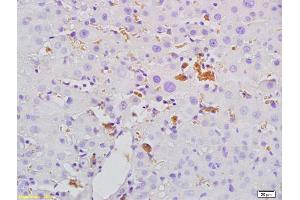 Formalin-fixed and paraffin embedded rat liver tissue labeled with Anti- Mannan Binding Lectin Polyclonal Antibody, Unconjugated (ABIN731663) at 1:200, followed by conjugation to the secondary antibody and DAB staining. (MBP/MBL antibody  (AA 31-130))