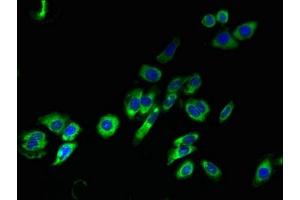 Immunofluorescent analysis of HepG2 cells using ABIN7172926 at dilution of 1:100 and Alexa Fluor 488-congugated AffiniPure Goat Anti-Rabbit IgG(H+L) (TM4SF1 antibody  (AA 115-161))