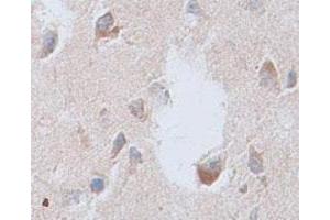 Immunohistochemical staining of formalin-fixed paraffin-embedded human brain tissue showing membrane staining with CNTFR polyclonal antibody  at 1 : 100 dilution.