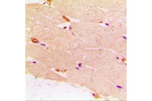 Immunohistochemical analysis of Desmin staining in human muscle formalin fixed paraffin embedded tissue section. (Desmin antibody  (C-Term))