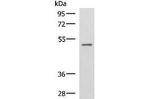Western blot analysis of Human placenta tissue lysate using GRWD1 Polyclonal Antibody at dilution of 1:800 (GRWD1 antibody)