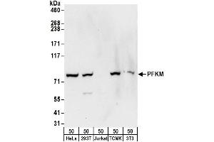 Western Blotting (WB) image for anti-phosphofructokinase, Muscle (PFKM) (AA 1-50) antibody (ABIN7450557)