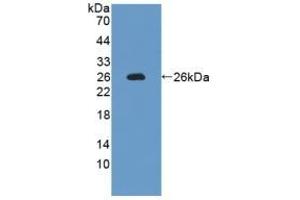 Detection of Recombinant IL12A, Rat using Polyclonal Antibody to Interleukin 12A (IL12A) (IL12A antibody  (AA 23-215))