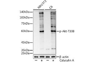 Western blot analysis of extracts of various cell lines, using Phospho-Akt-T308 antibody (ABIN7271240) at 1:1000 dilution. (AKT1 antibody  (pThr308))