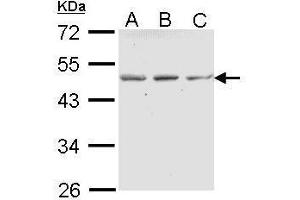 WB Image Sample (30 ug of whole cell lysate) A: A431 , B: H1299 C: Hela 10% SDS PAGE antibody diluted at 1:1000 (ENTPD5 antibody  (Center))