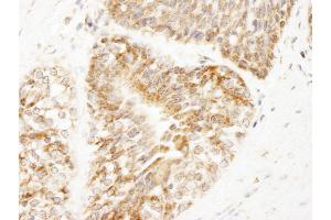 Immunohistochemistry (IHC) image for anti-A Kinase (PRKA) Anchor Protein 1 (AKAP1) (AA 375-425) antibody (ABIN7448928)