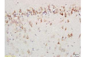 Formalin-fixed and paraffin embedded labeled with rat brain Anti-AMBRA1 Polyclonal Antibody, Unconjugated 1:200 followed by conjugation to the secondary antibody and DAB staining (AMBRA1 antibody  (AA 221-320))