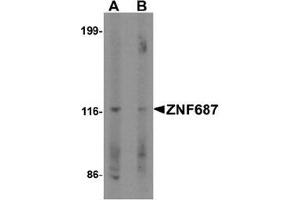 Western blot analysis of ZNF687 in Jurkat cell lysate with ZNF687 Antibody  at 0. (ZNF687 antibody  (C-Term))