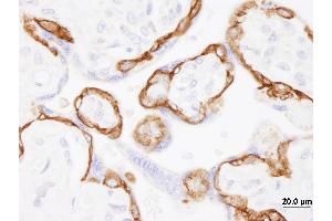 Immunohistochemistry (IHC) image for anti-Epidermal Growth Factor Receptor (EGFR) (C-Term) antibody (ABIN7454624)