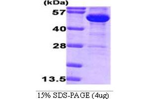 SDS-PAGE (SDS) image for Glucose-6-Phosphate Dehydrogenase (G6PD) (AA 1-491) protein (ABIN666886) (Glucose-6-Phosphate Dehydrogenase Protein (G6PD) (AA 1-491))