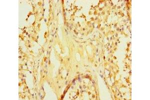 Immunohistochemistry of paraffin-embedded human testis tissue using ABIN7166855 at dilution of 1:100 (C8orf77 antibody  (AA 1-214))