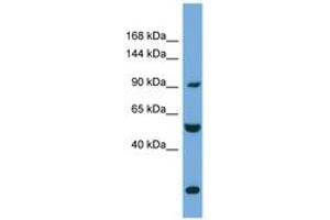 Image no. 1 for anti-Exocyst Complex Component 1 (EXOC1) (AA 35-84) antibody (ABIN6745695) (EXOC1 antibody  (AA 35-84))