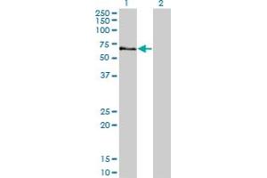 Western Blot analysis of STK3 expression in transfected 293T cell line by STK3 monoclonal antibody (M13), clone 4F7. (STK3 antibody  (AA 311-431))