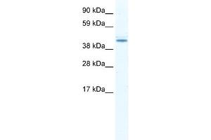 WB Suggested Anti-DDX49 Antibody Titration:  2. (DDX49 antibody  (N-Term))