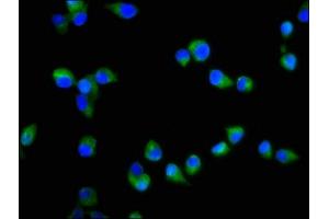 Immunofluorescence staining of SH-SY5Y cells with ABIN7170569 at 1:200, counter-stained with DAPI.