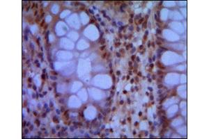Immunohistochemistry (IHC) image for anti-Structural Maintenance of Chromosomes 1A (SMC1A) antibody (ABIN1844787)