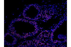 Immunofluorescence (IF) image for anti-Matrin 3 (MATR3) (C-Term) antibody (ABIN7448986) (MATR3 antibody  (C-Term))