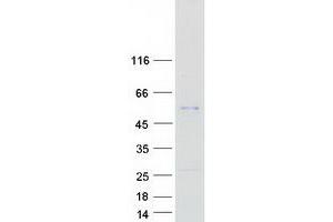 Validation with Western Blot (SERPINA4 Protein (Myc-DYKDDDDK Tag))