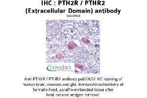 Image no. 1 for anti-Parathyroid Hormone 2 Receptor (PTH2R) (1st Extracellular Domain), (pThr2) antibody (ABIN1738582) (PTH2R antibody  (1st Extracellular Domain, pThr2))