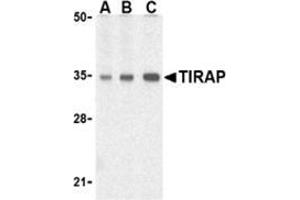 Western blot analysis of TIRAP in human heart cell lysates with this product at (A) 0. (TIRAP antibody  (C-Term))