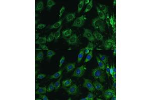 Immunofluorescence analysis of C6 cells using Galectin 3/Galectin 3/LG antibody (ABIN6130437, ABIN6143158, ABIN6143159 and ABIN7101422) at dilution of 1:100. (Galectin 3 antibody  (AA 1-250))