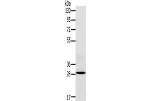 Western Blotting (WB) image for anti-Triggering Receptor Expressed On Myeloid Cells 2 (TREM2) antibody (ABIN2434061) (TREM2 antibody)