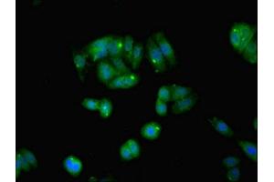 Immunofluorescent analysis of HepG2 cells using ABIN7160542 at dilution of 1:100 and Alexa Fluor 488-congugated AffiniPure Goat Anti-Rabbit IgG(H+L) (MYL6 antibody  (AA 3-151))