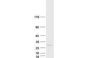 COMMD5 Protein (Transcript Variant 3) (Myc-DYKDDDDK Tag)