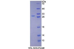 SDS-PAGE (SDS) image for Lysyl Oxidase-Like 1 (LOXL1) (AA 369-574) protein (His tag) (ABIN1080231) (LOXL1 Protein (AA 369-574) (His tag))