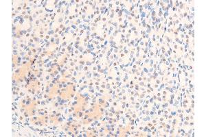 ABIN6267305 at 1/100 staining rat gastric tissue sections by IHC-P. (C-JUN antibody  (pThr239))