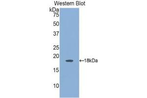 Western blot analysis of the recombinant protein. (Angiopoietin 2 antibody  (AA 24-165))
