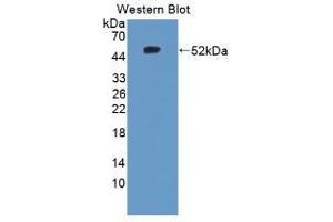 Western blot analysis of the recombinant protein. (TNC antibody  (AA 174-621))